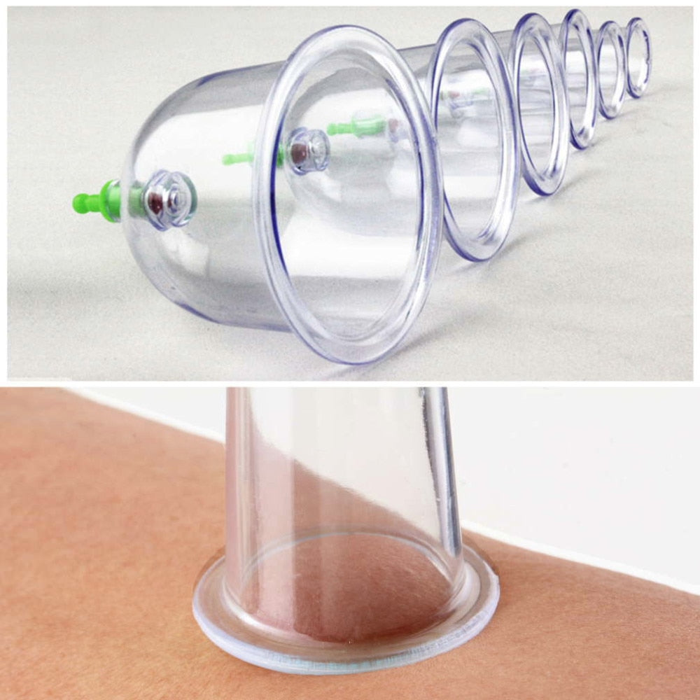 Cupping Therapy Set with Suction Tools (12-Piece)